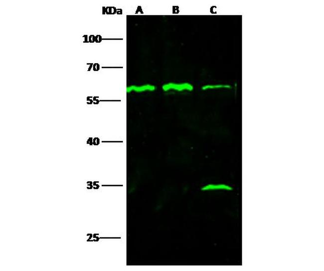 TNFR1 Antibody in Western Blot (WB)