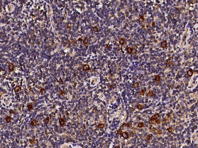 CD30 Antibody in Immunohistochemistry (Paraffin) (IHC (P))