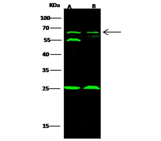 TRAF6 Antibody in Western Blot (WB)