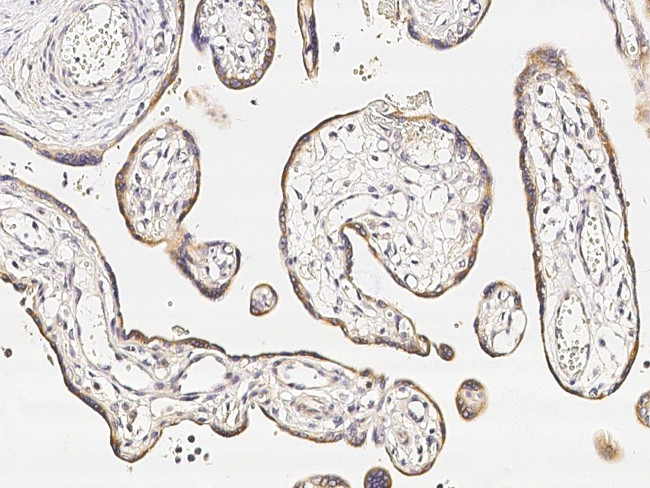 TREM1 Antibody in Immunohistochemistry (Paraffin) (IHC (P))