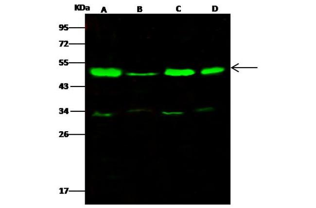 TSG101 Antibody in Western Blot (WB)