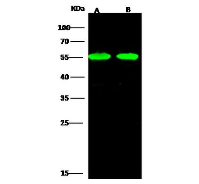 beta-3 Tubulin Antibody in Western Blot (WB)