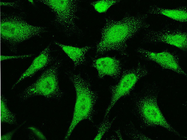 UBC9 Antibody in Immunocytochemistry (ICC/IF)