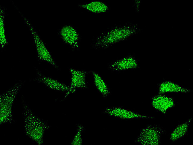 E6AP Antibody in Immunocytochemistry (ICC/IF)