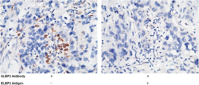 ULBP2 Antibody in Immunohistochemistry (Paraffin) (IHC (P))