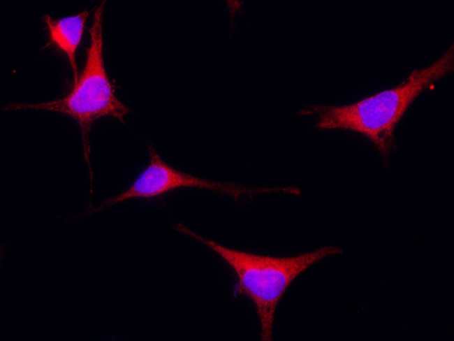 UNG Antibody in Immunocytochemistry (ICC/IF)