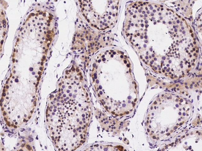 UNG Antibody in Immunohistochemistry (Paraffin) (IHC (P))