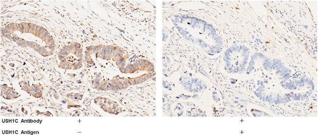 USH1C Antibody in Immunohistochemistry (Paraffin) (IHC (P))