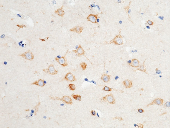 VAPB Antibody in Immunohistochemistry (Paraffin) (IHC (P))