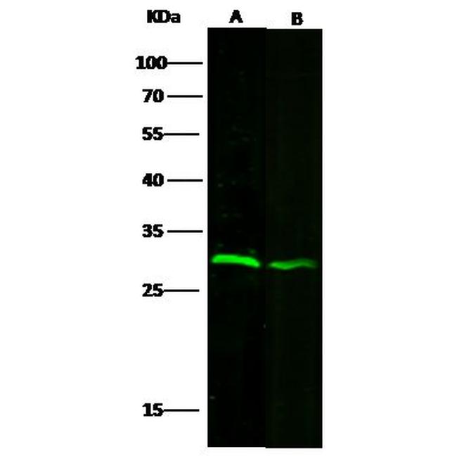 VAPB Antibody in Western Blot (WB)