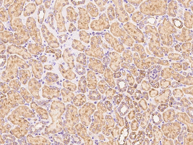 VISTA Antibody in Immunohistochemistry (Paraffin) (IHC (P))