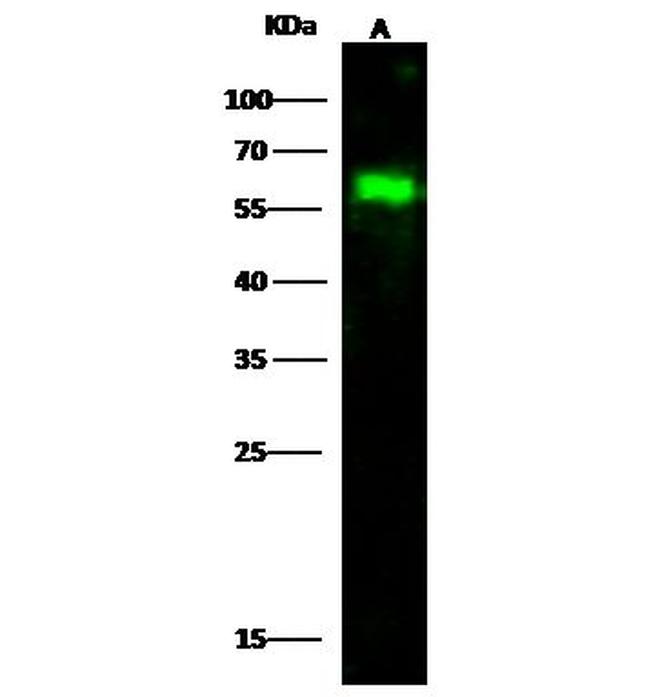 WTAP Antibody in Western Blot (WB)