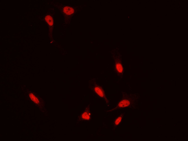 ZIC3 Antibody in Immunocytochemistry (ICC/IF)