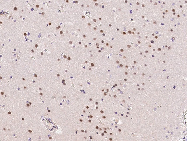 ZIC3 Antibody in Immunohistochemistry (Paraffin) (IHC (P))