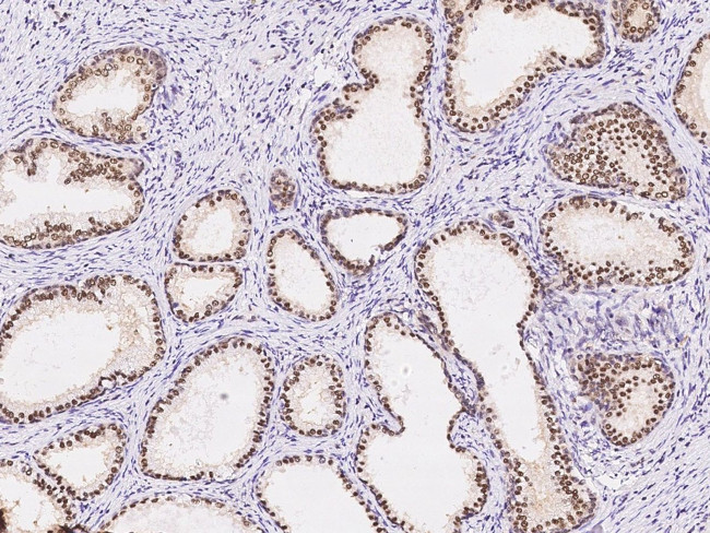 ZIC3 Antibody in Immunohistochemistry (Paraffin) (IHC (P))