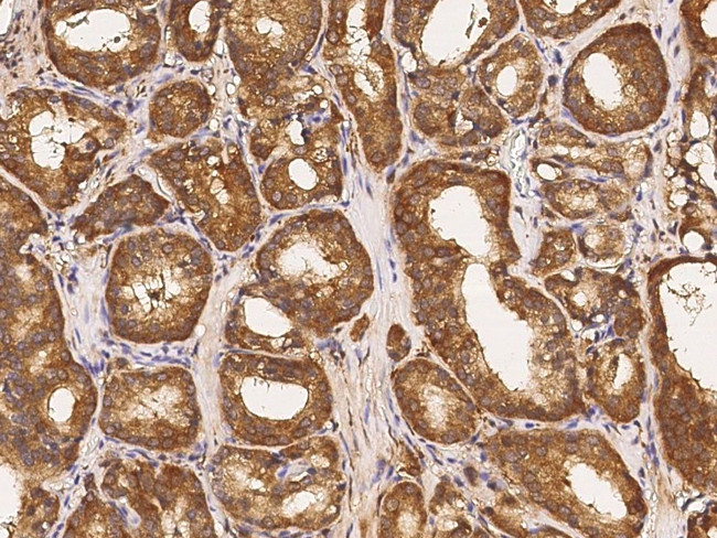 ABCF2 Antibody in Immunohistochemistry (Paraffin) (IHC (P))