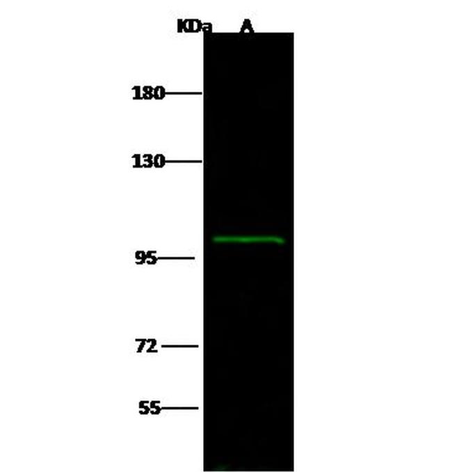 beta-1 Adaptin Antibody in Western Blot (WB)