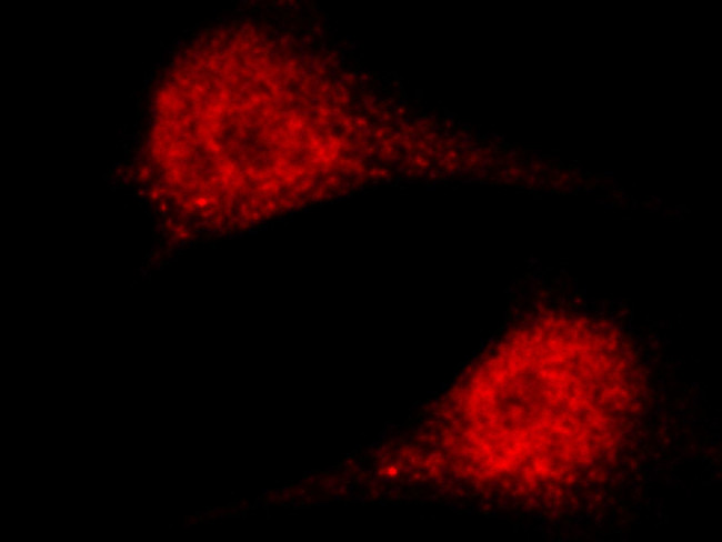 ASF1A Antibody in Immunocytochemistry (ICC/IF)