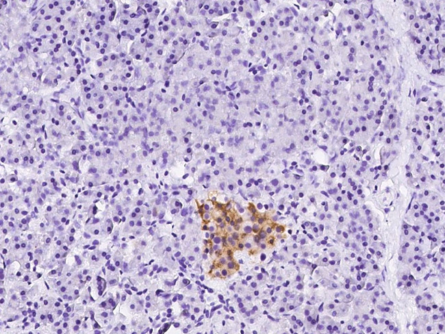 ATP6IP2 Antibody in Immunohistochemistry (Paraffin) (IHC (P))