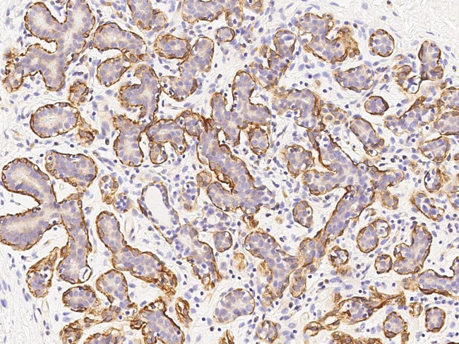 Calponin 1 Antibody in Immunohistochemistry (Paraffin) (IHC (P))