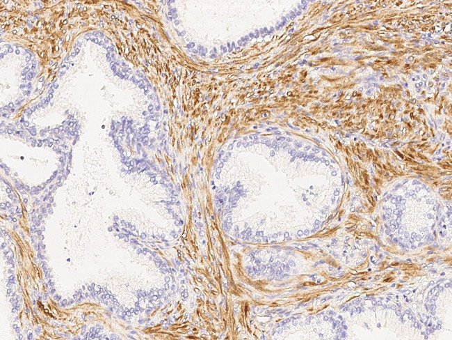 Calponin 1 Antibody in Immunohistochemistry (Paraffin) (IHC (P))