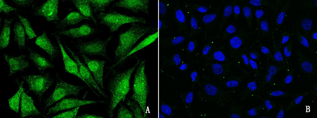 CBP Antibody in Immunocytochemistry (ICC/IF)