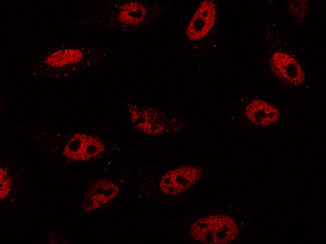 VDR Antibody in Immunocytochemistry (ICC/IF)