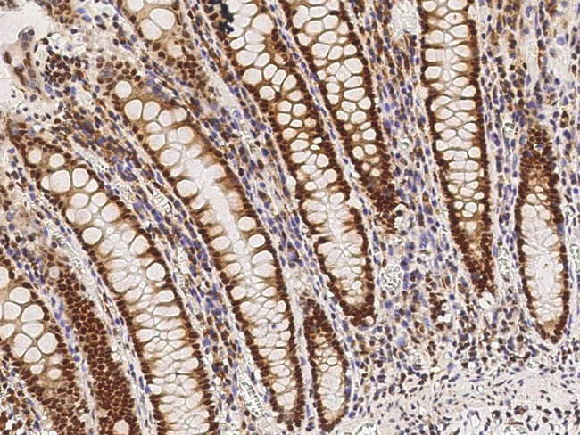 VDR Antibody in Immunohistochemistry (Paraffin) (IHC (P))