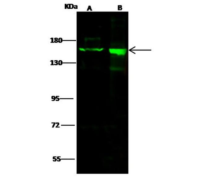 Drosha Antibody in Western Blot (WB)