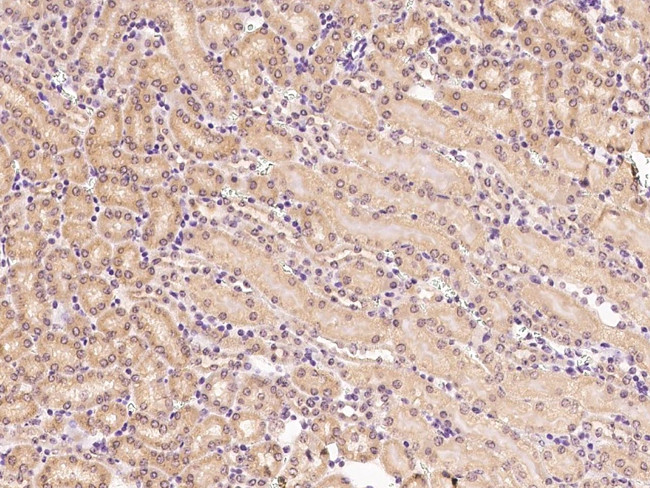 HuR Antibody in Immunohistochemistry (Paraffin) (IHC (P))