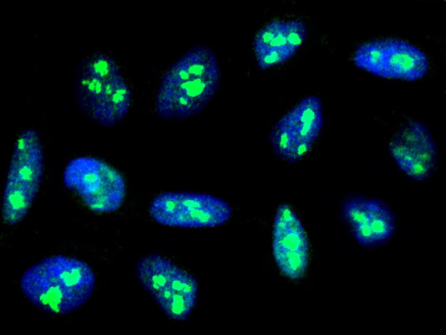 Fibrillarin Antibody in Immunocytochemistry (ICC/IF)