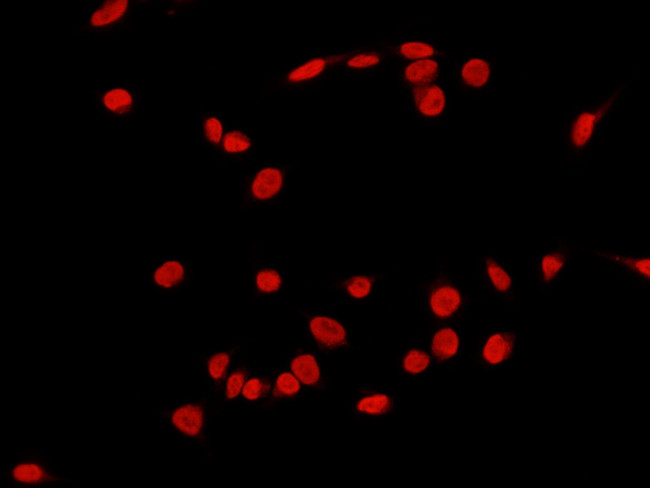 c-Fos Antibody in Immunocytochemistry (ICC/IF)