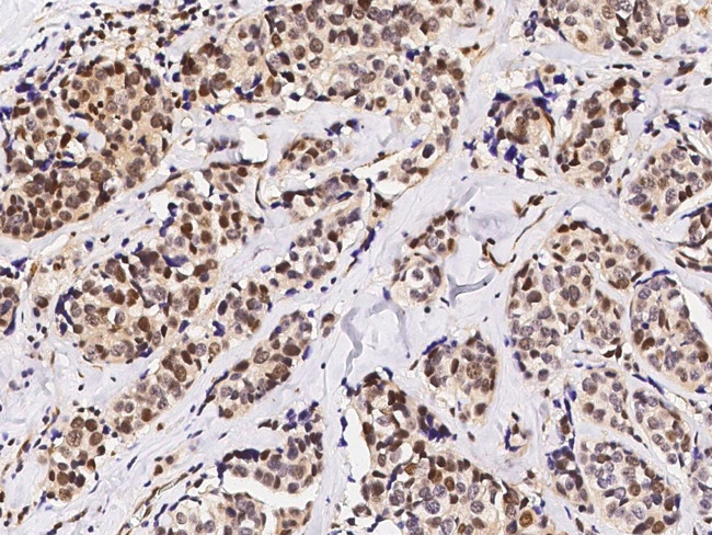 c-Fos Antibody in Immunohistochemistry (Paraffin) (IHC (P))