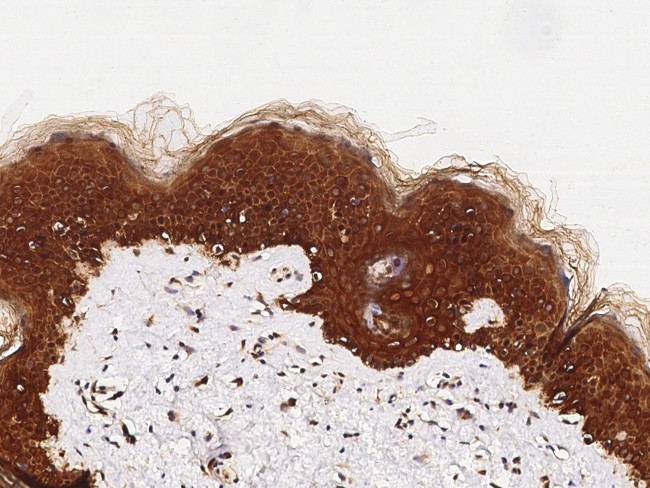 c-Fos Antibody in Immunohistochemistry (Paraffin) (IHC (P))