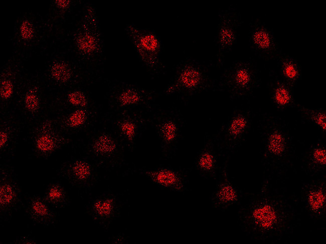 Fra1 Antibody in Immunocytochemistry (ICC/IF)