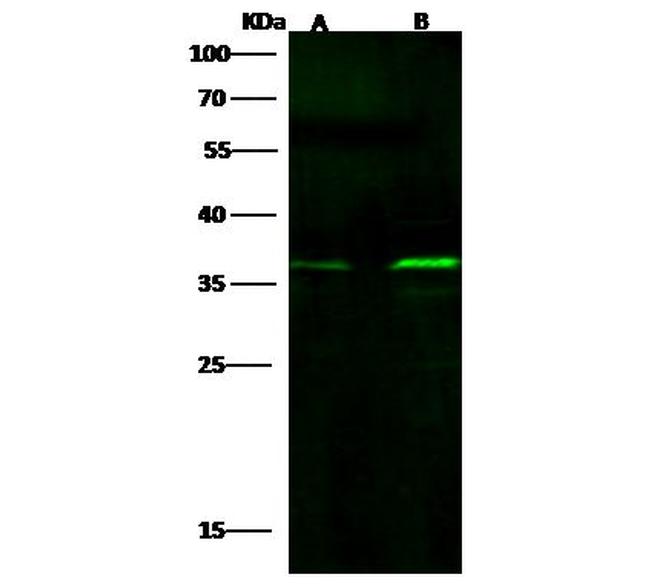 Fra1 Antibody in Western Blot (WB)