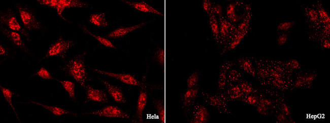 GLI1 Antibody in Immunocytochemistry (ICC/IF)