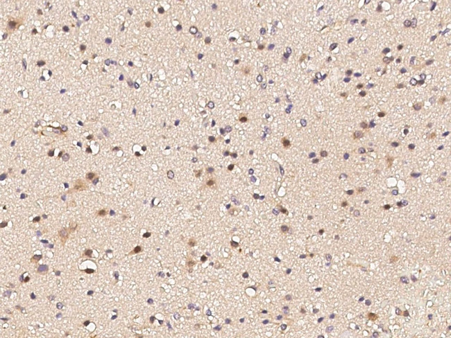 GLI1 Antibody in Immunohistochemistry (Paraffin) (IHC (P))