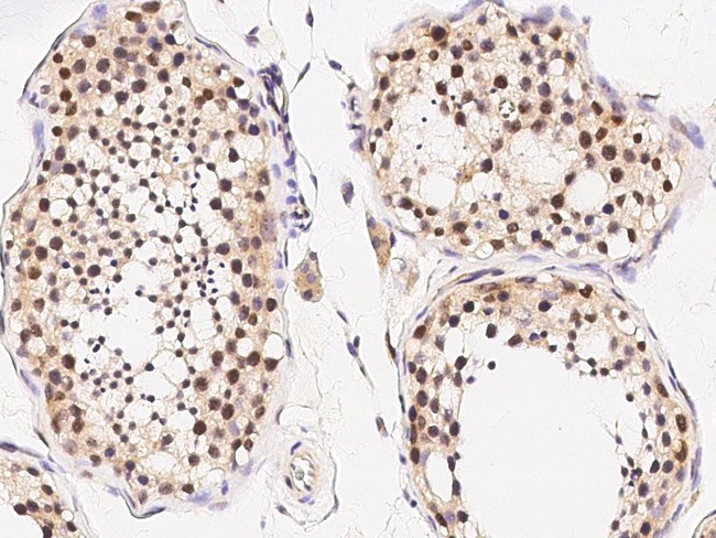 GLI1 Antibody in Immunohistochemistry (Paraffin) (IHC (P))