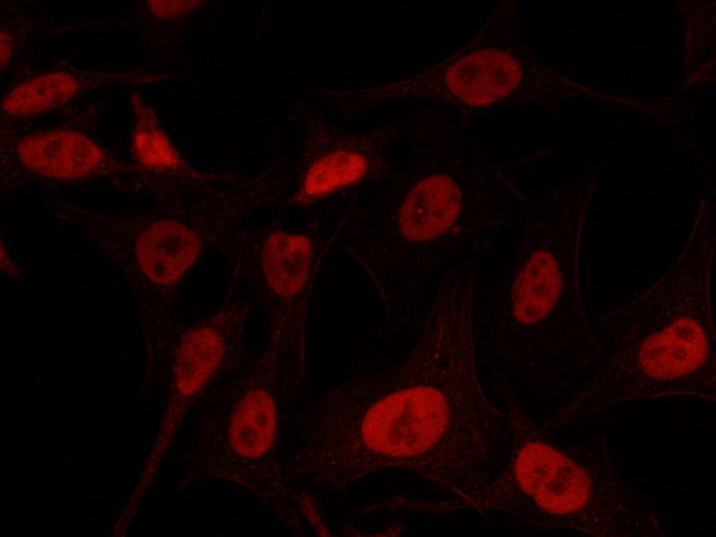 HAT1 Antibody in Immunocytochemistry (ICC/IF)