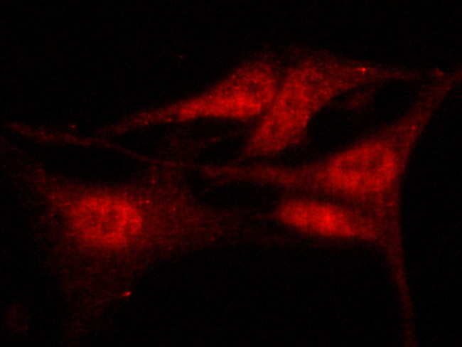 HDAC4 Antibody in Immunocytochemistry (ICC/IF)