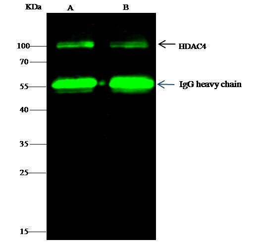 HDAC4 Antibody in Immunoprecipitation (IP)