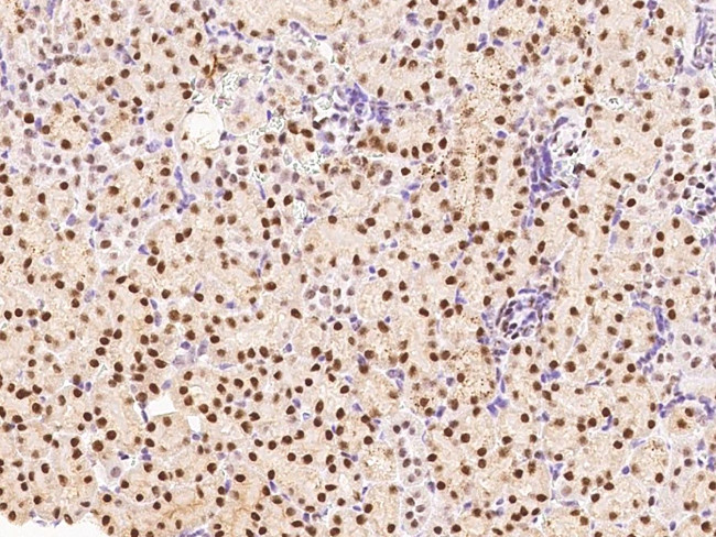 HEXIM1 Antibody in Immunohistochemistry (Paraffin) (IHC (P))