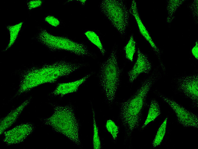 HIPK1 Antibody in Immunocytochemistry (ICC/IF)