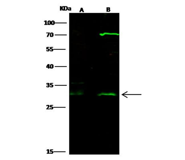 HOXB8 Antibody in Western Blot (WB)