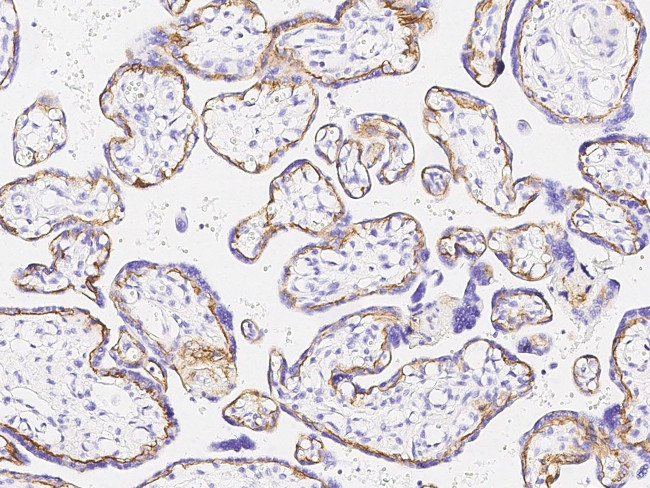 CD104 Antibody in Immunohistochemistry (Paraffin) (IHC (P))