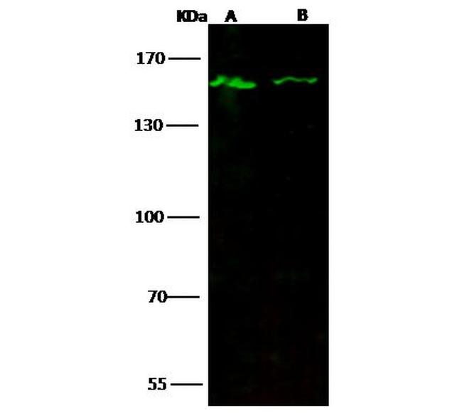 JMJD1A Antibody in Western Blot (WB)