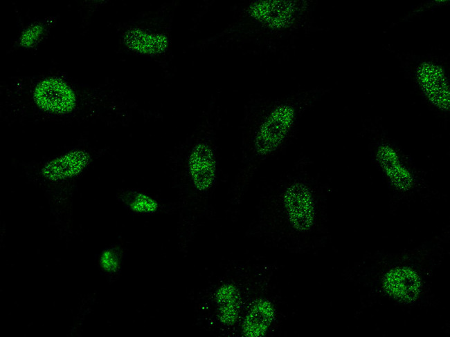 Lamin A Antibody in Immunocytochemistry (ICC/IF)