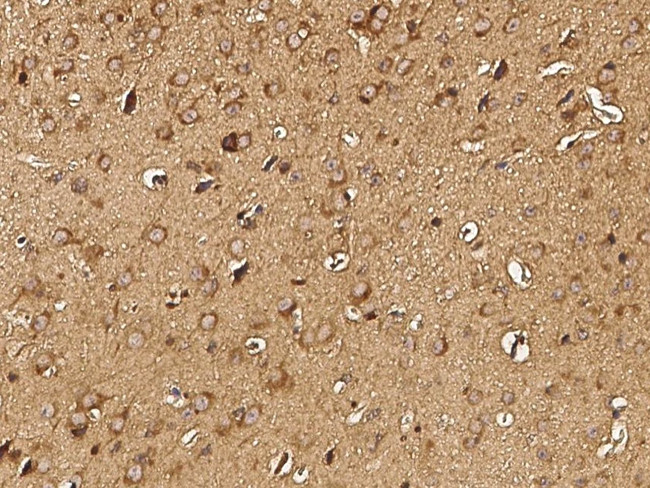 LRP1 Antibody in Immunohistochemistry (Paraffin) (IHC (P))