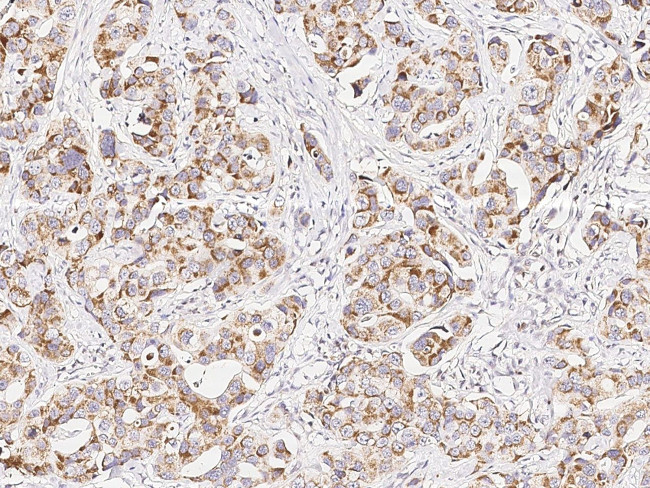 p38 MAPK beta Antibody in Immunohistochemistry (Paraffin) (IHC (P))